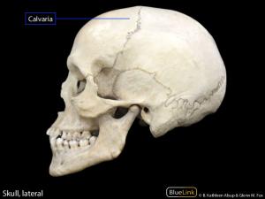 BL HiRes D1 S4 Cranial Cavity Venous Sinuses & Brain 2016.pdf ...